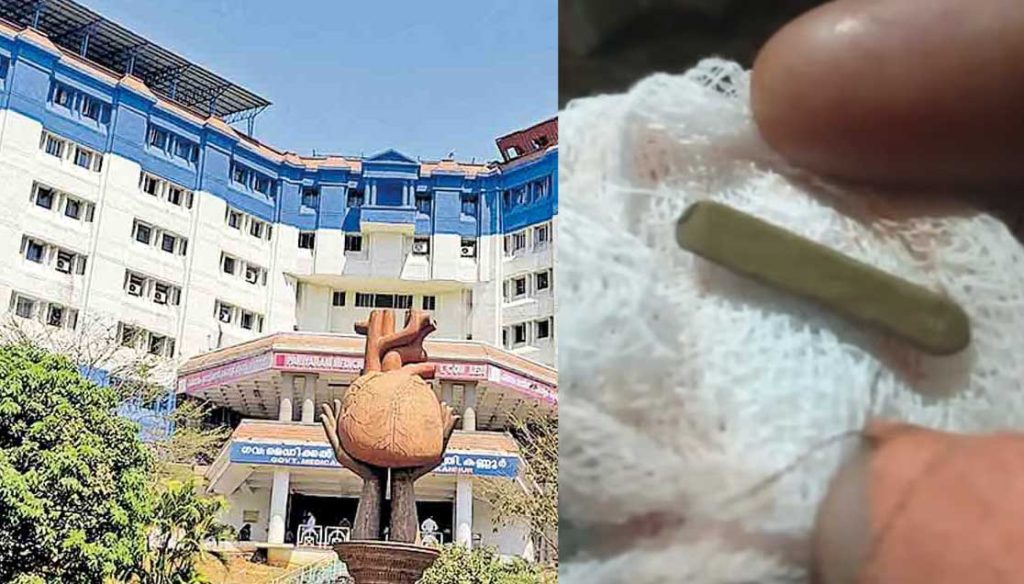 അഞ്ചു വയസുകാരിയുടെ മൂക്കില് പെന്സില് തറച്ചുകയറി; ഡോക്ടര്മാര് അതിവിദഗ്ദ്ധമായി പുറത്തെടുത്തു